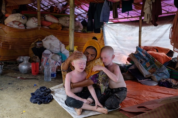 A Rohingya woman comforts her two sons in their tent in the Kutupalong camp in Cox's Bazar, Bangladesh. The family recently fled Myanmar joining hundreds of thousands of Rohingya who have fled across the border during episodes of violence in previous years, moving into makeshift settlements without adequate access to shelter, food, clean water, or proper sanitation.