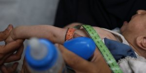 Gaza: MSF finds 1 in 4 young children and pregnant women malnourished as Israel's policy of starvation continues