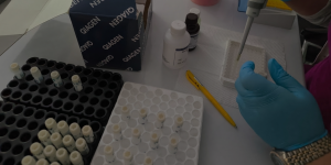 Tajikistan: MSF concludes Zero TB project in Kulob